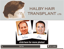Tablet Screenshot of hairandeyebrowtransplant.com